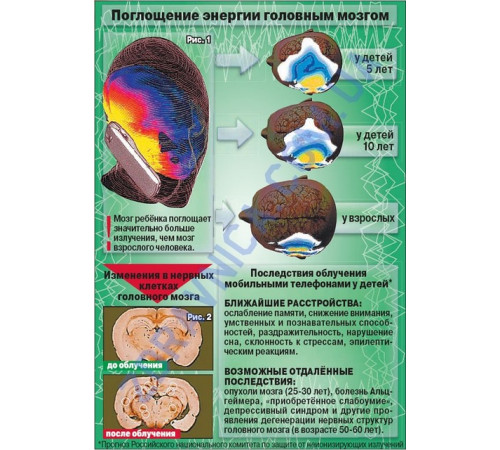 Турмаліновий захист у разі випромінювання мобільних телефонів