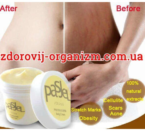 Крем проти розтяжок Pasje
