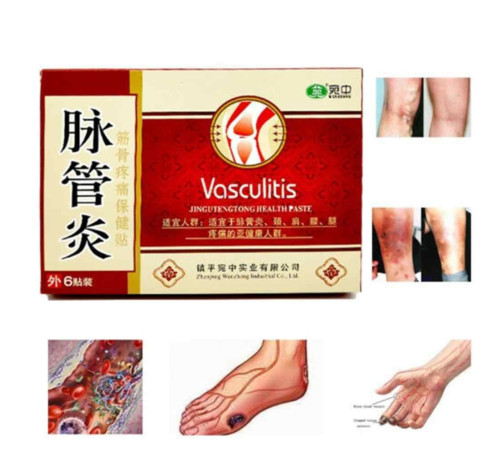 Китайські пластирі у разі варикозного розширення вен Васкулітіс Vaskulitis Васкуліт (6 шт.)