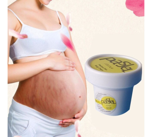 Крем проти розтяжок Pasje