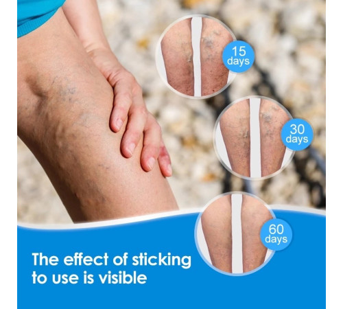 Пластир проти варикозу та васкуліту Тибетський з турмаліном Чжао Цзюньфен 8 шт.