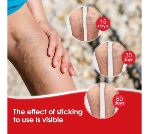 Пластир від варикозного розширення вен із турмаліном Гонконг 6 шт.