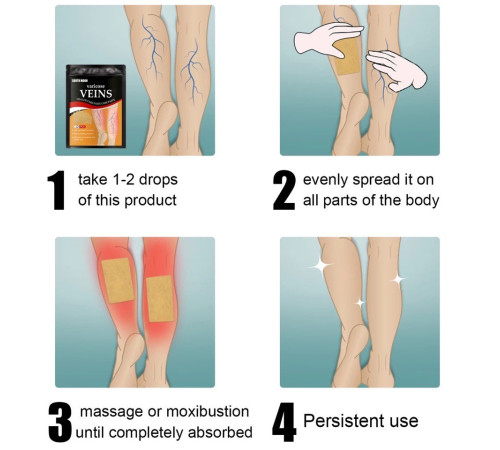 Пластир проти варикозного розширення вен із турмаліном, полегшення болю в ногах, набряк, пластир із дощовим червом
