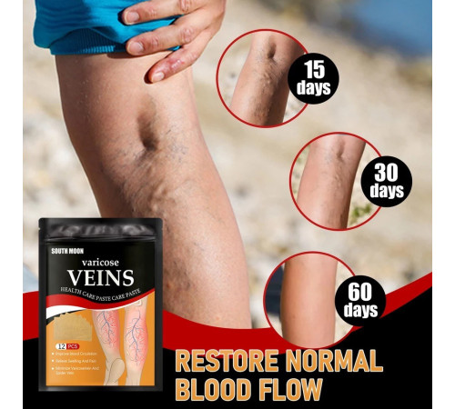 Пластир проти варикозного розширення вен із турмаліном, полегшення болю в ногах, набряк, пластир із дощовим червом