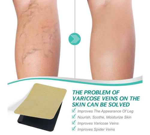 Пластир проти варикозного розширення вен і судинних зірочок на ногах 8 шт.