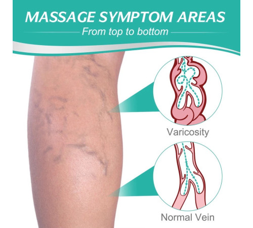 Пластир проти варикозного розширення вен і судинних зірочок на ногах 8 шт.