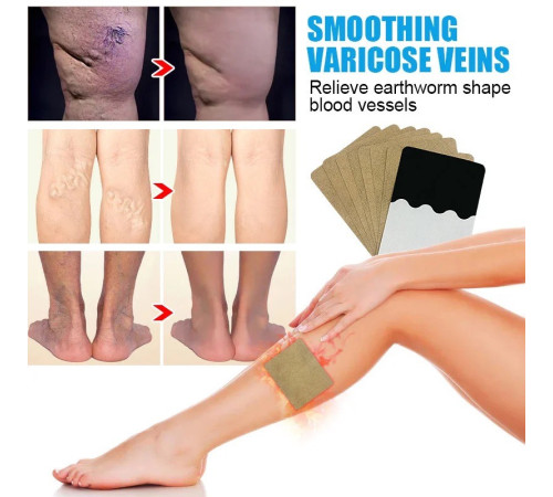 Пластир від варикозного розширення вен, васкуліту, тромбозу з турмаліном Гонконг 8 шт.