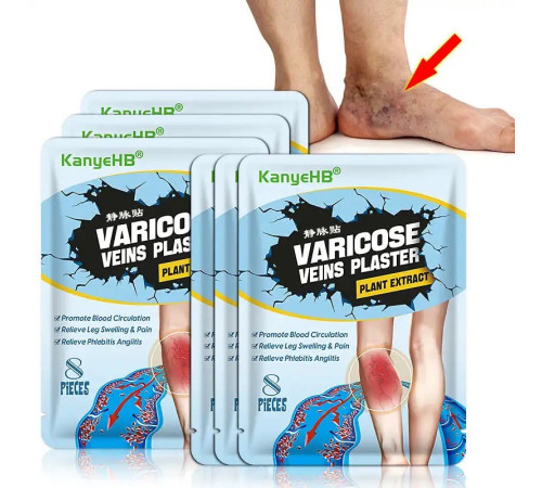 Пластир від варикозного розширення вен, васкуліту, тромбозу з турмаліном Гонконг 8 шт.