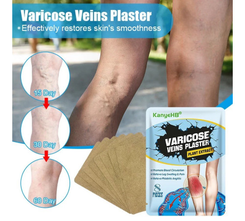 Пластир від варикозного розширення вен, васкуліту, тромбозу з турмаліном Гонконг 8 шт.