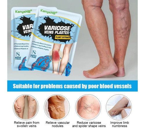 Пластир від варикозного розширення вен, васкуліту, тромбозу з турмаліном Гонконг 8 шт.