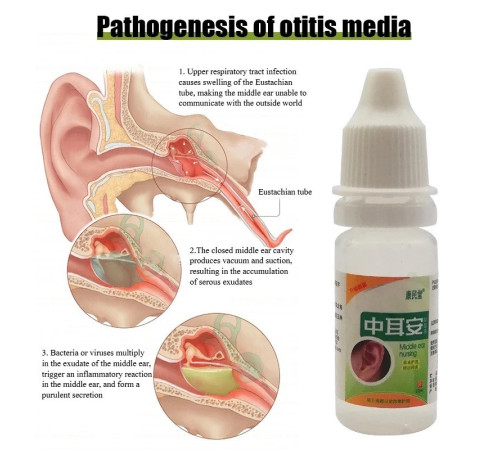 Китайські Вушні краплі антибактеріальні від отиту та запалення вуха, від закладеності