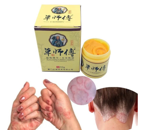 Крем мазь "Король шкіри", (фуфан) у баночці 10 г. мазь від псоріазу Вековий Схід