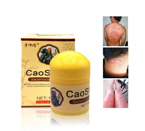 Крем мазь "Король шкіри", (фуфан) у баночці 10 г. мазь від псоріазу Вековий Схід