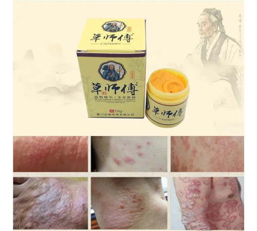 Крем мазь "Король шкіри", (фуфан) у баночці 10 г. мазь від псоріазу Вековий Схід