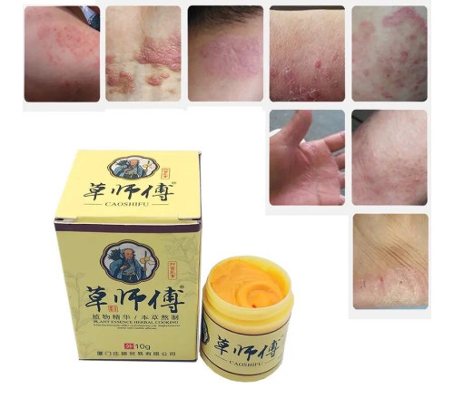 Крем мазь "Король шкіри", (фуфан) у баночці 10 г. мазь від псоріазу Вековий Схід