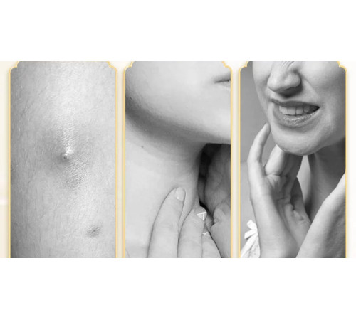 Протизапальні таблетки Pudilan Xiaoyan Pian  у разі фурункульозу, фарингіту, тонзиліту, ангіні, ГРВ Грип