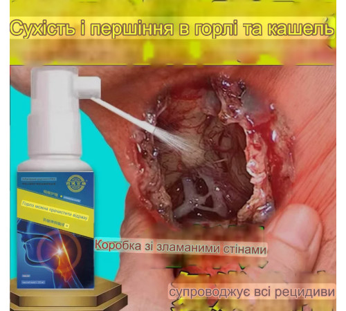 Турмаліновий спрей проти болю в горлі, від запалення періння, ангіне, у разі втрати голосу, у разі різних інфекцій