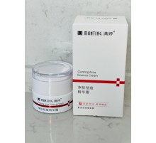 Крем Мантинг під час демодекозів, вугрів Вековий Схід