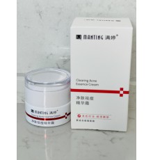 Крем Мантинг під час демодекозів, вугрів Вековий Схід