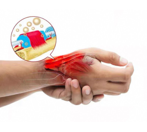 Китайський крем від тендосиніту, болю в зап'ястку, труднощів розтягування, тенісного ліктів 50 грамів