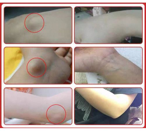 Китайський крем від тендосиніту, болю в зап'ястку, труднощів розтягування, тенісного ліктів 50 грамів