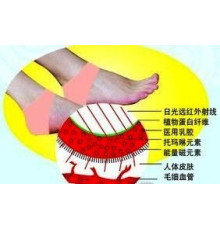 Турмалінові нап'яточники — під час терапії п'ят Вековий Схід