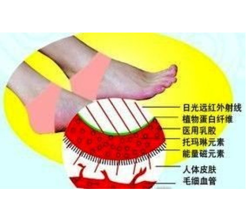 Турмалінові нап'яточники — під час терапії п'ят Вековий Схід